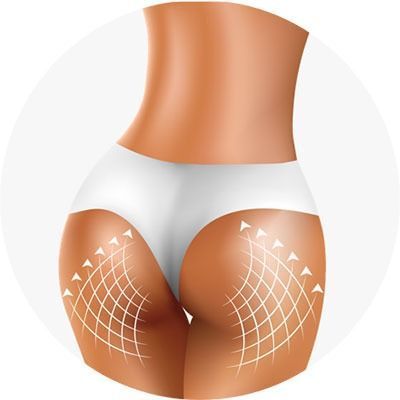 Anti-cellulite serum Beauty Booty Serum for buttocks, 150 ml